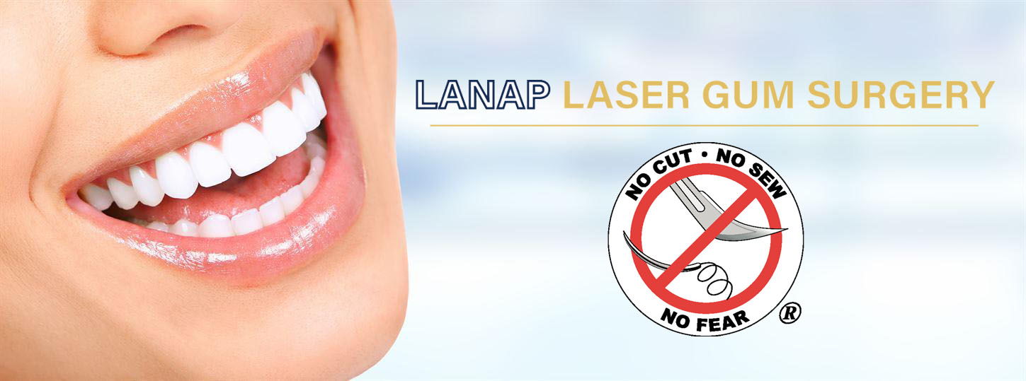 LANAP Laser Gum Surgery - Dentist Lafayette LA | Emergency Dental ...