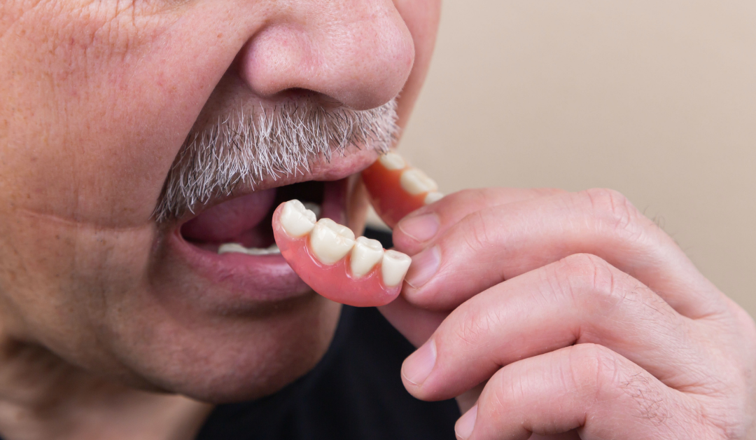 Understanding the Different Types of Partial Dentures
