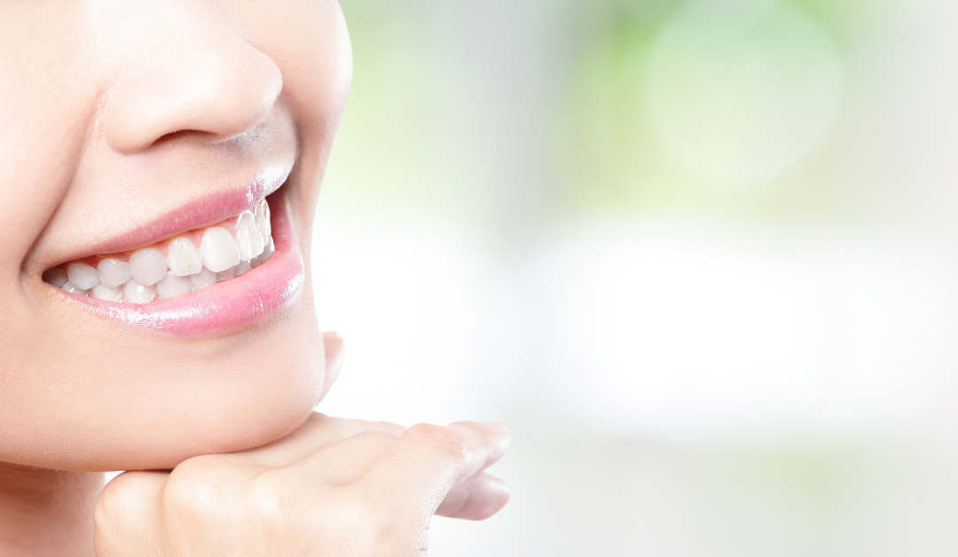 Teeth Whitening: Professional vs At Home – How Long Do They Last