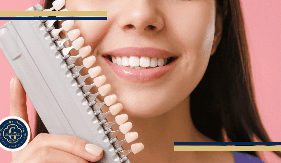 Porcelain Veneers vs. Composite Veneers Explained